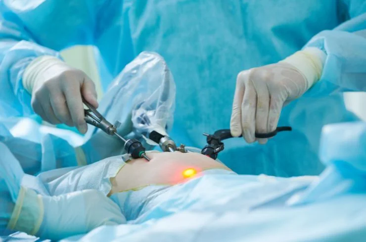 Laparoscopy Surgery Citi Hospital